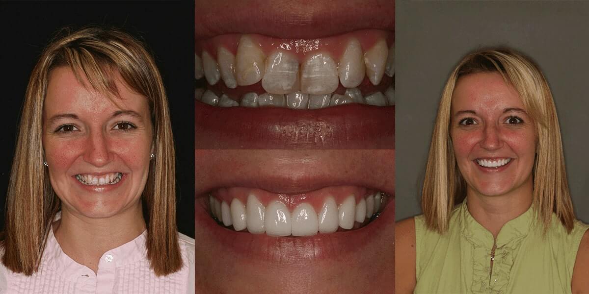 Cosmetic Dentists